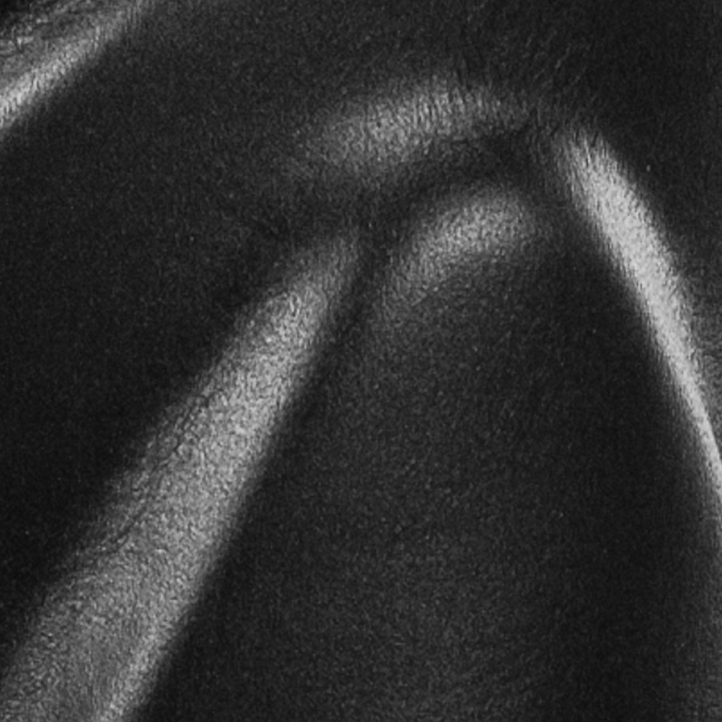 CONTOURED, HIGH- COMPRESSION FOAM